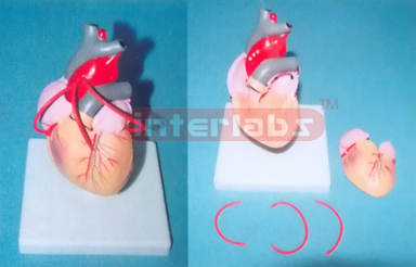 ADULT NATURAL HEART MODEL WITH BYPASS (SHORT BLOOD TUBE)